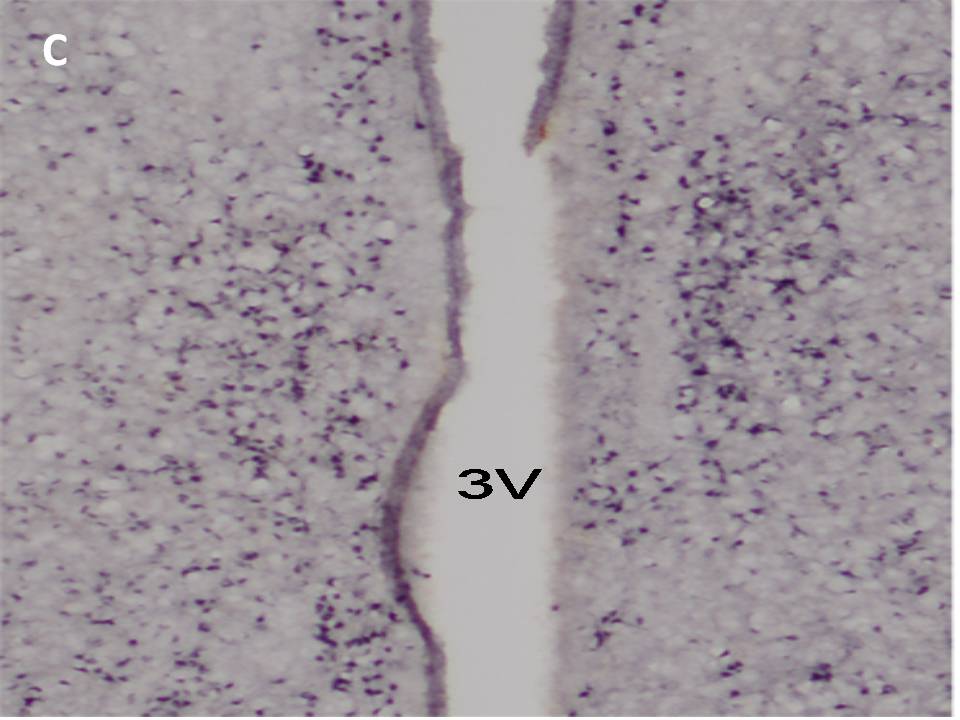 Estrogen receptor α immunoreactivity in the medial preoptic nuclei and the periventricular nuclei of an adult female rat